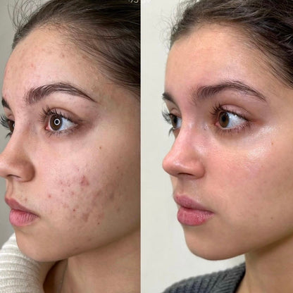 Perfecteur De Teint - Stick Coréen